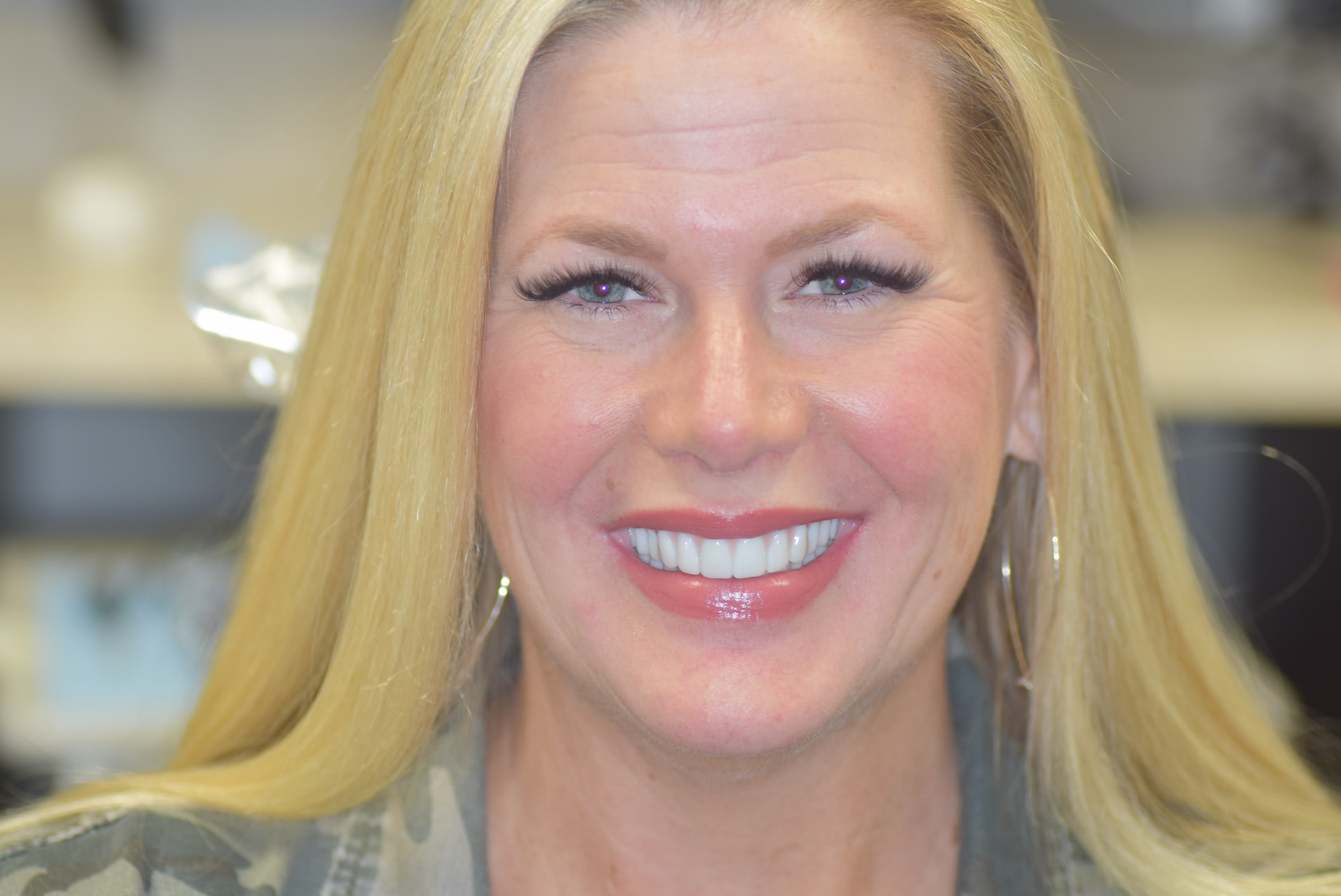 Tiffany smiling confidently after full-mouth implant reconstruction