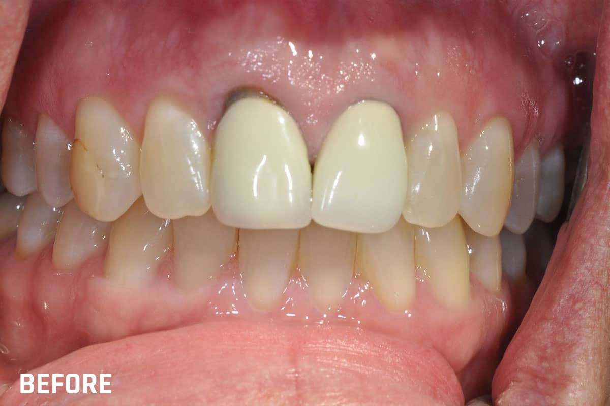Periodontist in Tulsa