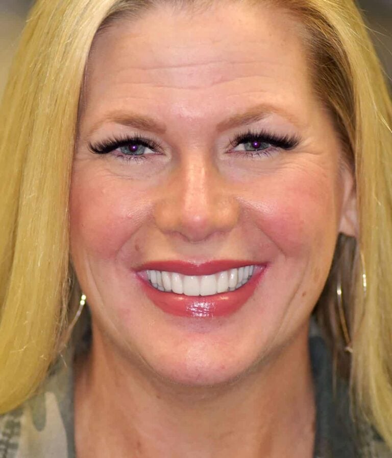 Tulsa Bone Graft