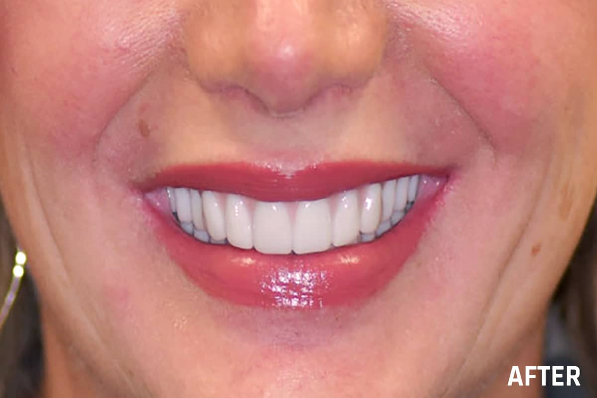 Periodontist in Tulsa