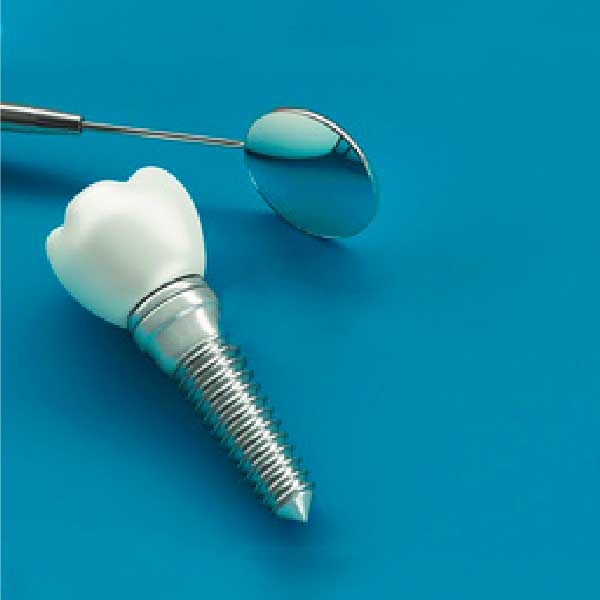 Dental Implants in Tulsa