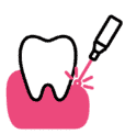 Dental Implants in Tulsa