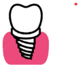 Dental Implants in Tulsa
