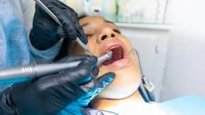 Tulsa Periodontal Disease