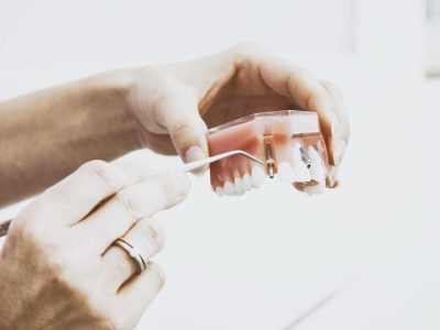 Periodontal Disease Tulsa