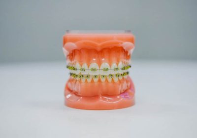 Periodontal Disease Tulsa
